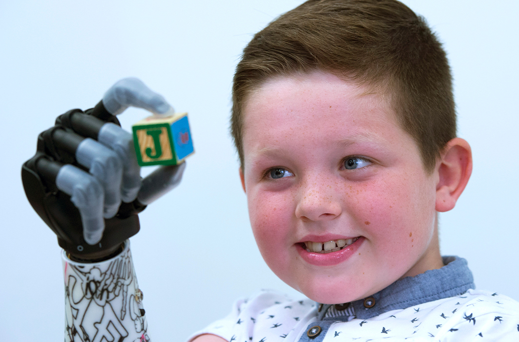 Un jeune enfant avec un bras artificiel technologique.