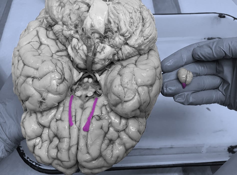 Cerveaux sous la loupe Cerveaux sous la loupe
