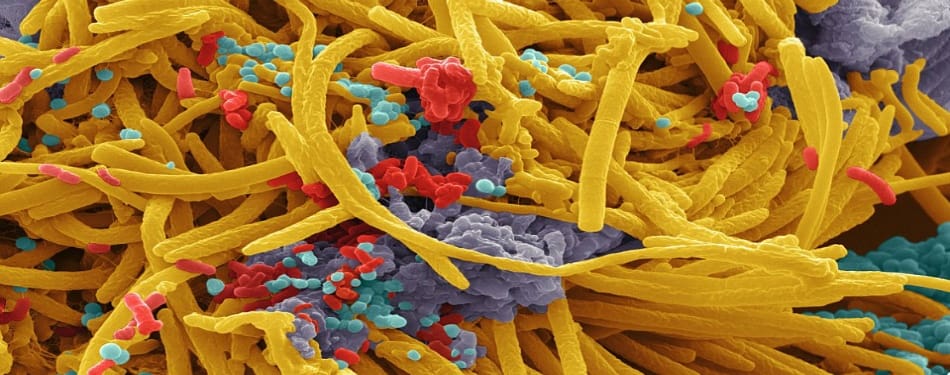 Virus? Bactérie? Petit lexique pour s'y retrouver!