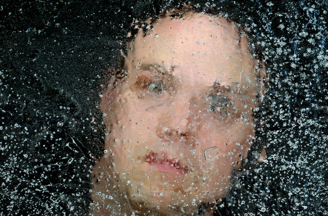 Se cryogéniser pour repousser la mort 