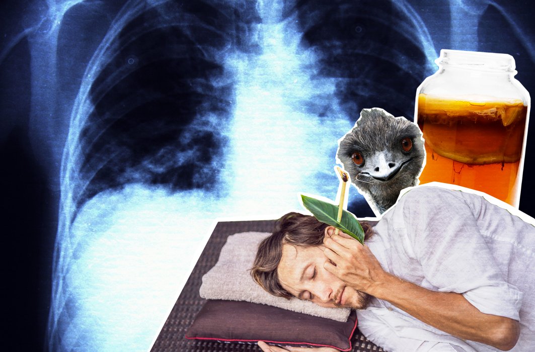 Montage photo, traitements étranges contre le cancer.