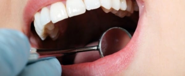 Un détecteur de mensonges dans les dents