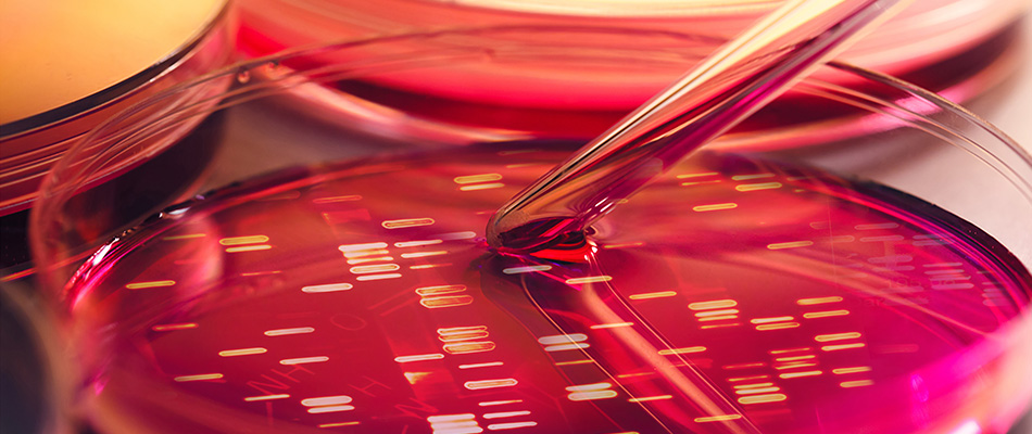 Un peu de variole dans votre entrepôt? Un peu de variole dans votre entrepôt?