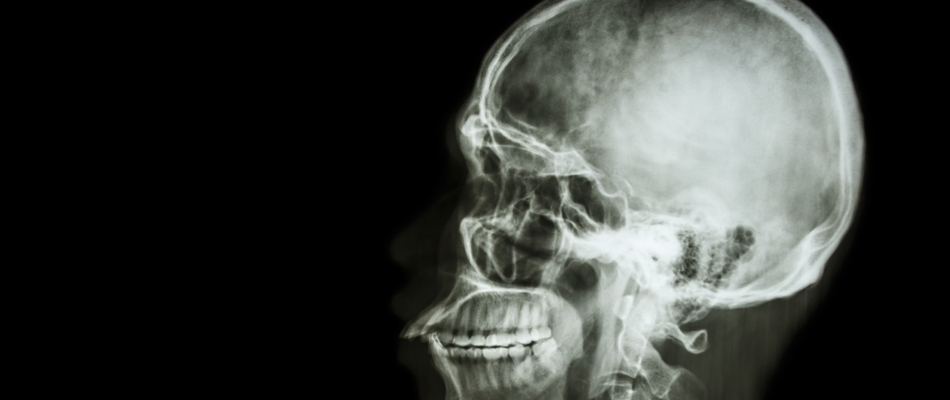 Vous utilisez autant votre cerveau que Scarlett Johansson