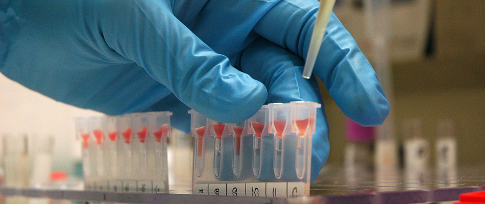 Un test sanguin pour prédire la tendance au suicide?