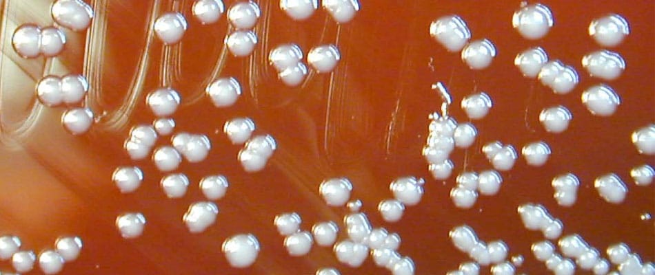 Ces dangereuses bactéries dont on perd la trace Ces dangereuses bactéries dont on perd la trace