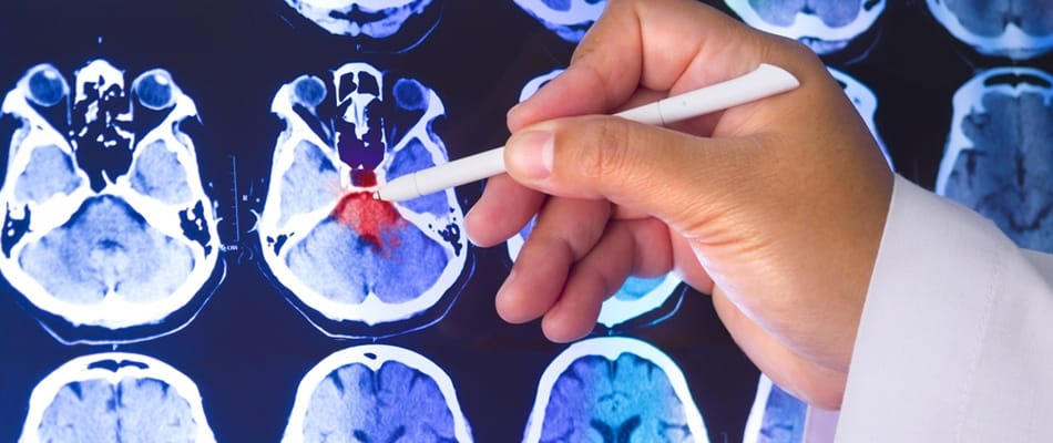 Terrorisme : prévenir ou guérir? Terrorisme : prévenir ou guérir?