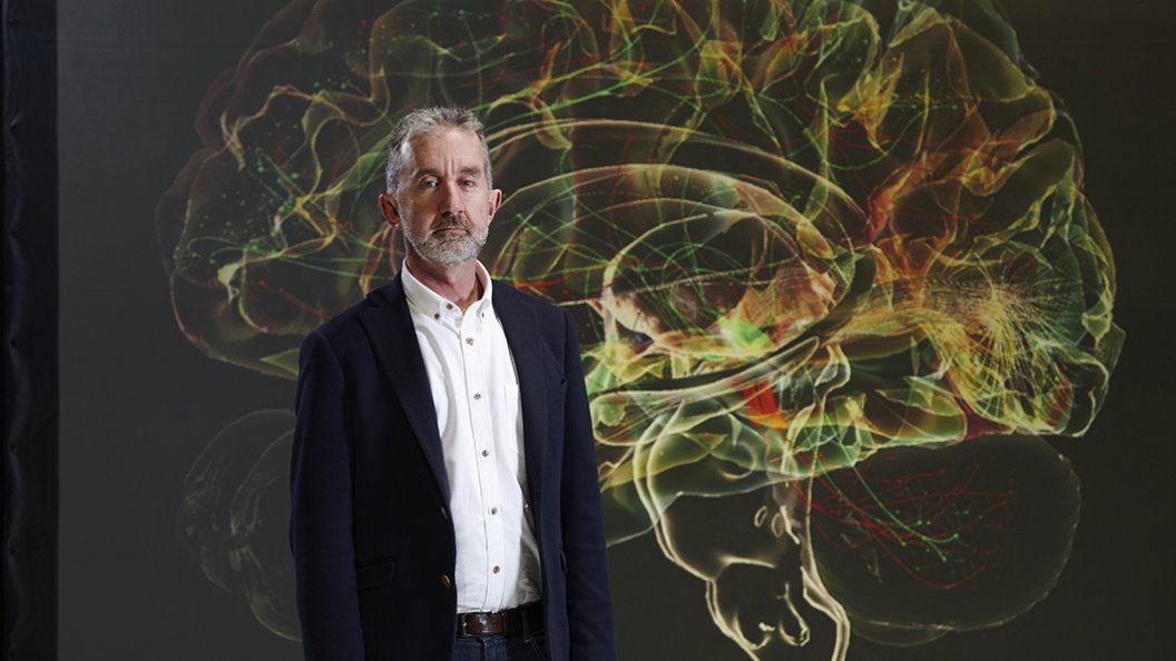 Fascinant cerveau